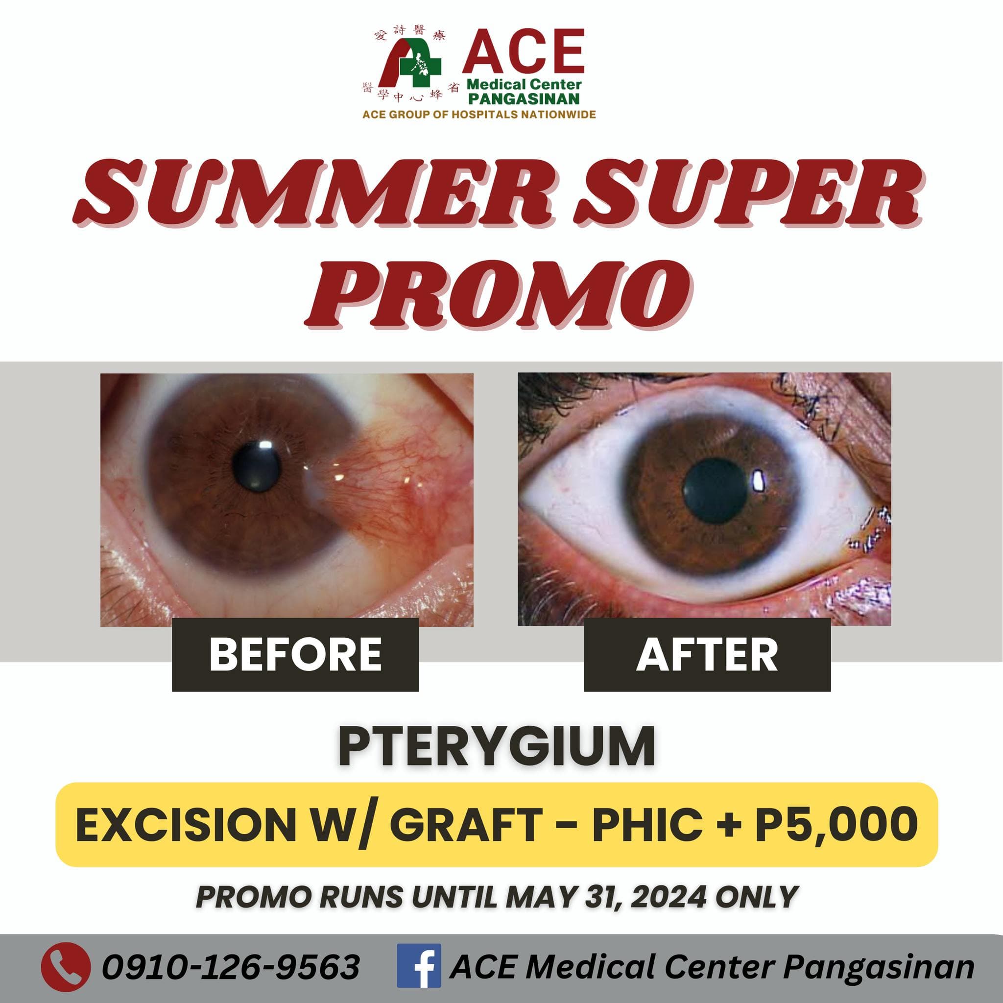 Summer Promo campaign poster.